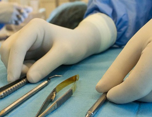 all-on-4-denti-inferiori-e-superiori-roma