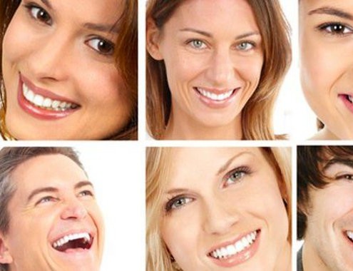 tasso di successo della tecnica di implantologia all-on-4