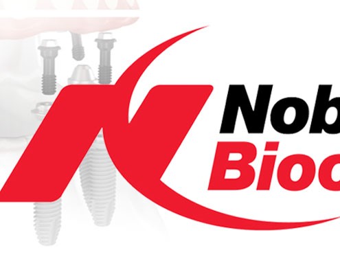 impianti-nobel-biocare-roma