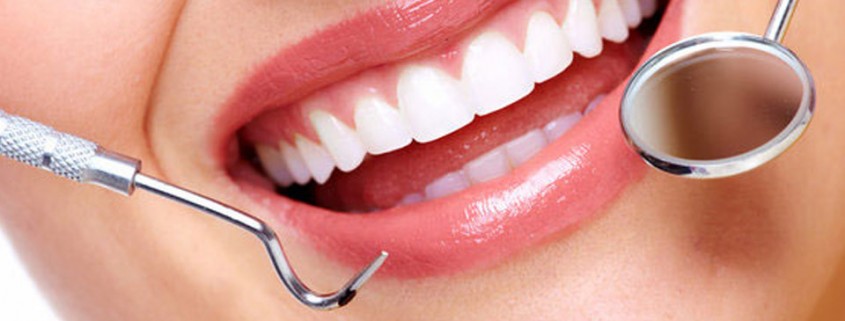 implantologia-dentale-post-estrattiva-roma