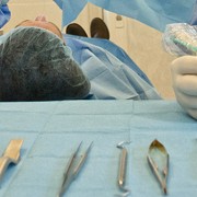 rimozione-vecchio-impianto-dentale-roma