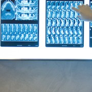 visita-odontoiatrica-gratuita-roma